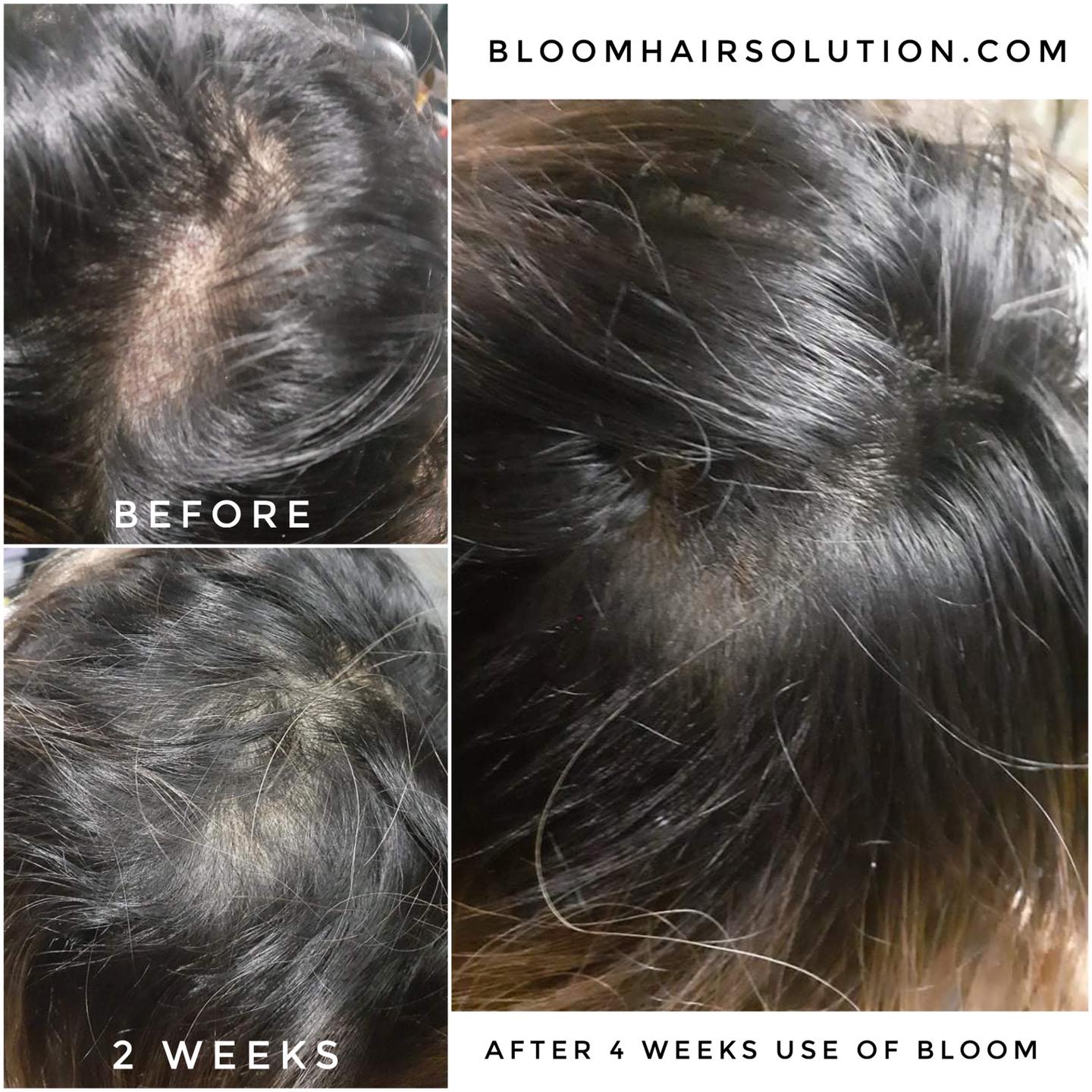 Bloom Hair | NEW Growth Essence