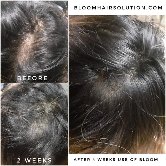 Bloom Hair | NEW Growth Essence Bundle